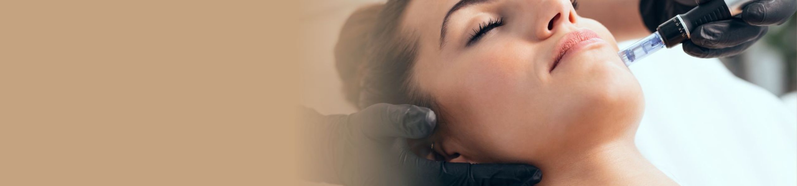 DERMAPEN tratamiento Facial en Laguna de Duero